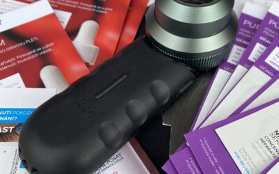 Kontrola znamének v onkokosmetické poradně